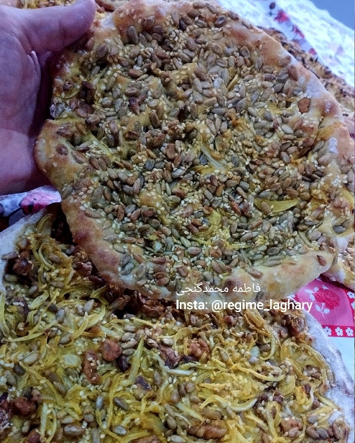 عکس گرده مغزی