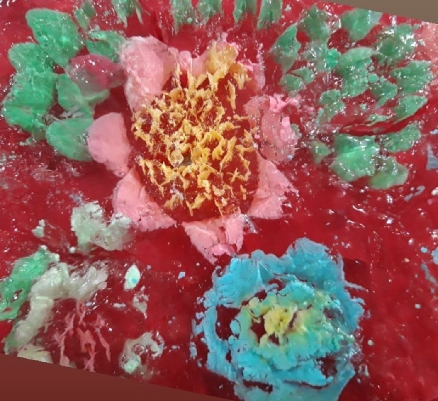 عکس ژله تزریقی ۲